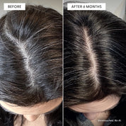 To The Root® Scalp Serum